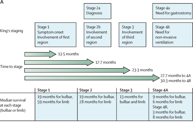 a diagram ofKing's staging of ALS, which rates the progression of the disease into stages 