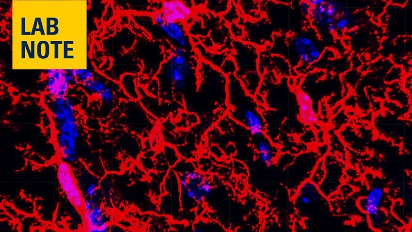 photo of microglia taken in the NeuroNetwork for Emerging Therapies lab