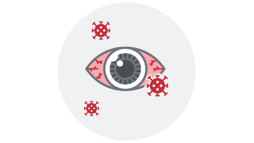 Graphic of a bloodshot eye with covid floating around it