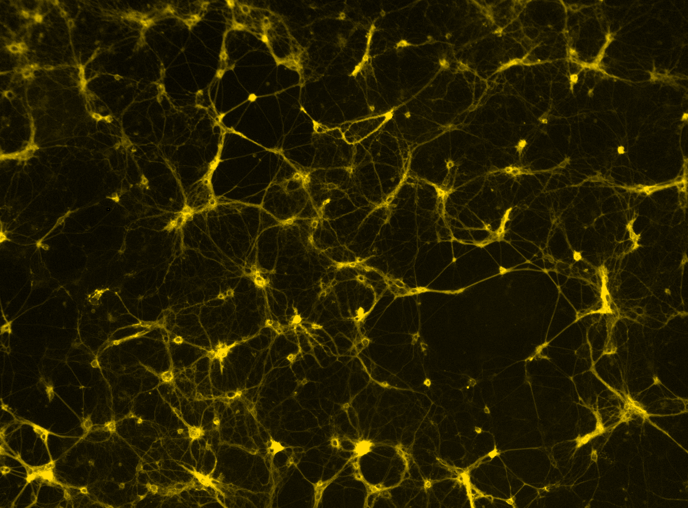 photo of Calcium (yellow) from motor neuron activation by neurotransmitters.