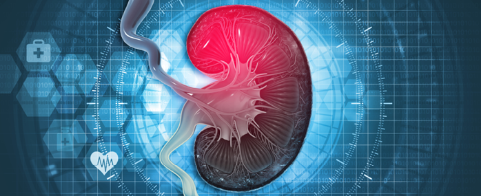 Supporting and Improving the U.S. Chronic Kidney Disease Surveillance System
