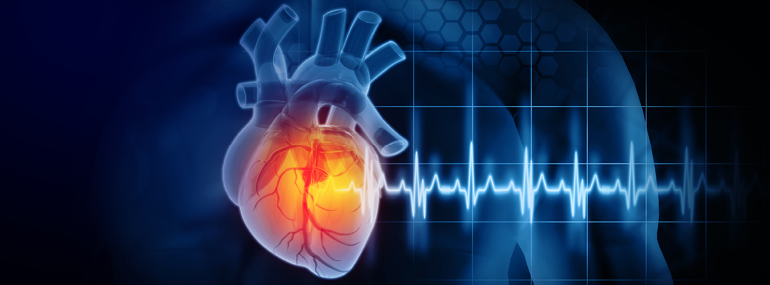 How Can Antiphospholipid Syndrome Affect My Heart Health?