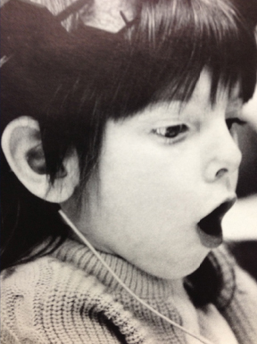 Nicole Burr hears for the first time with her cochlear implant, 1987