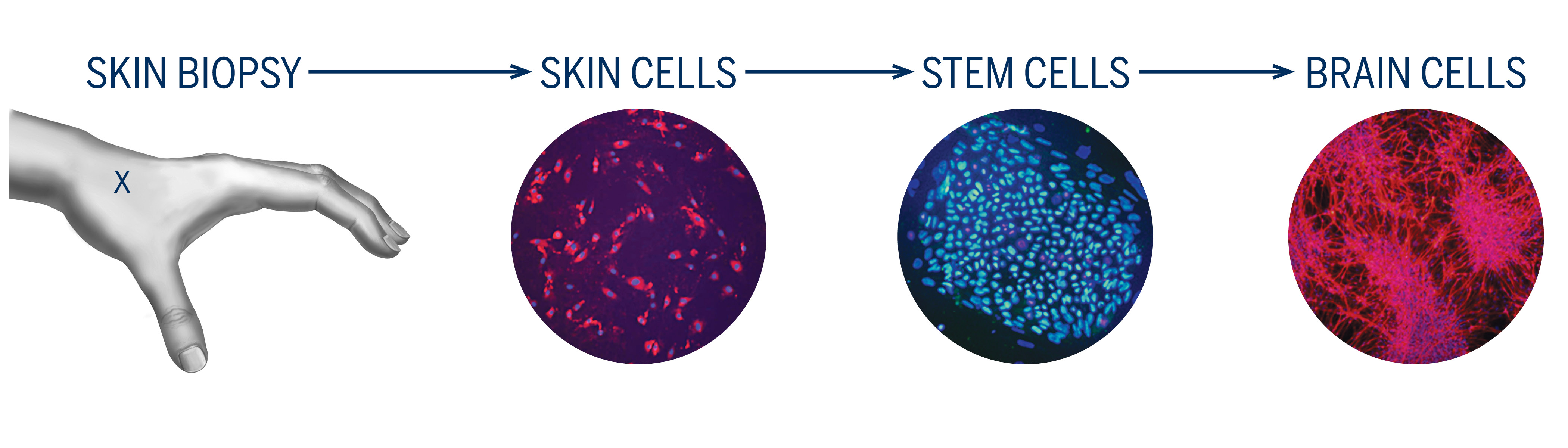 Skin biopsy image