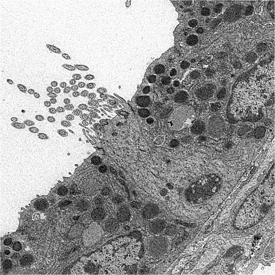 Electron micrograph of a mouse airway epithelium