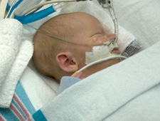 Child in Pediatric Cardiothoracic Intensive Care Unit