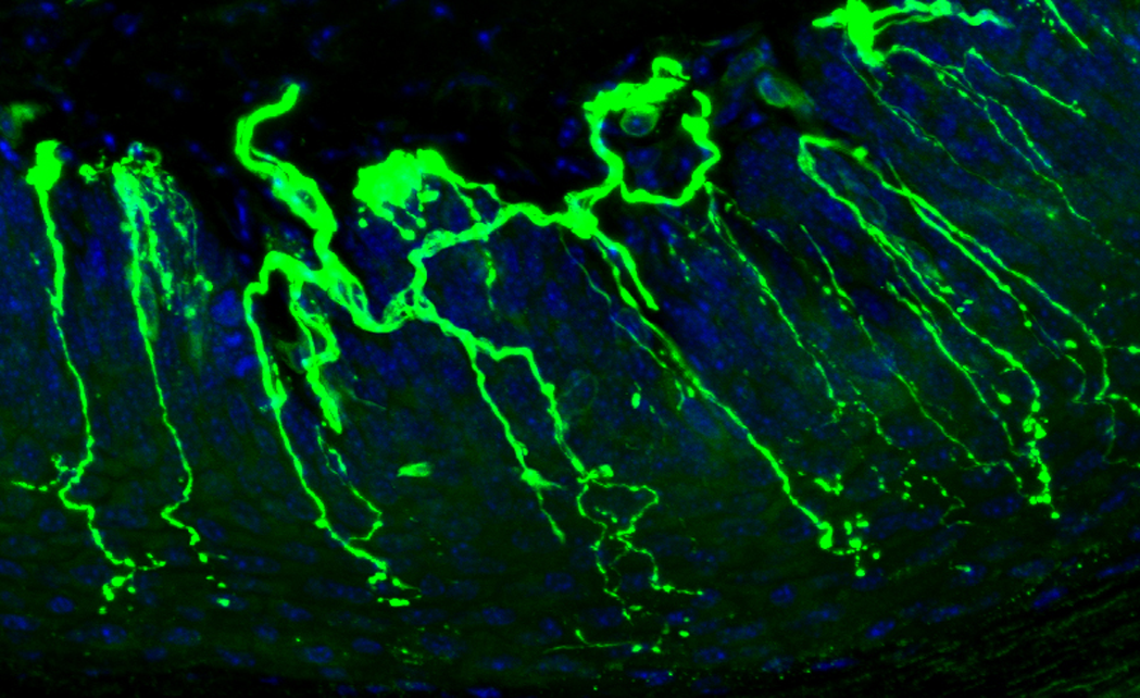 photo of nerve fibers penetrating the foot pad of an animal model in the NeuroNetwork for Emerging Therapies lab