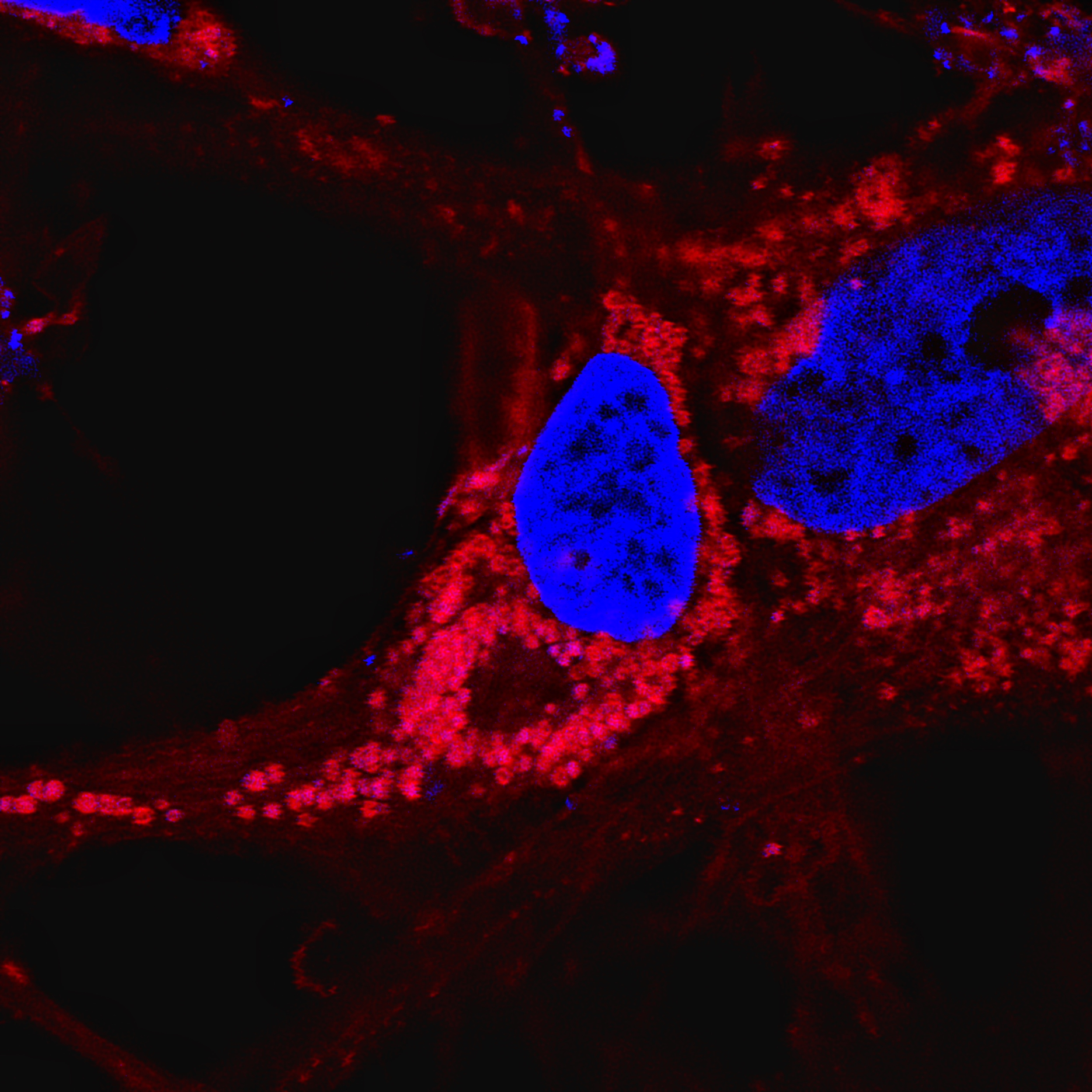 photo of extracellular vesicles around a nerve nucleus