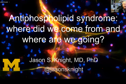 Antiphospholipid Syndrome: Where Did We Come from and Where Are We Going?