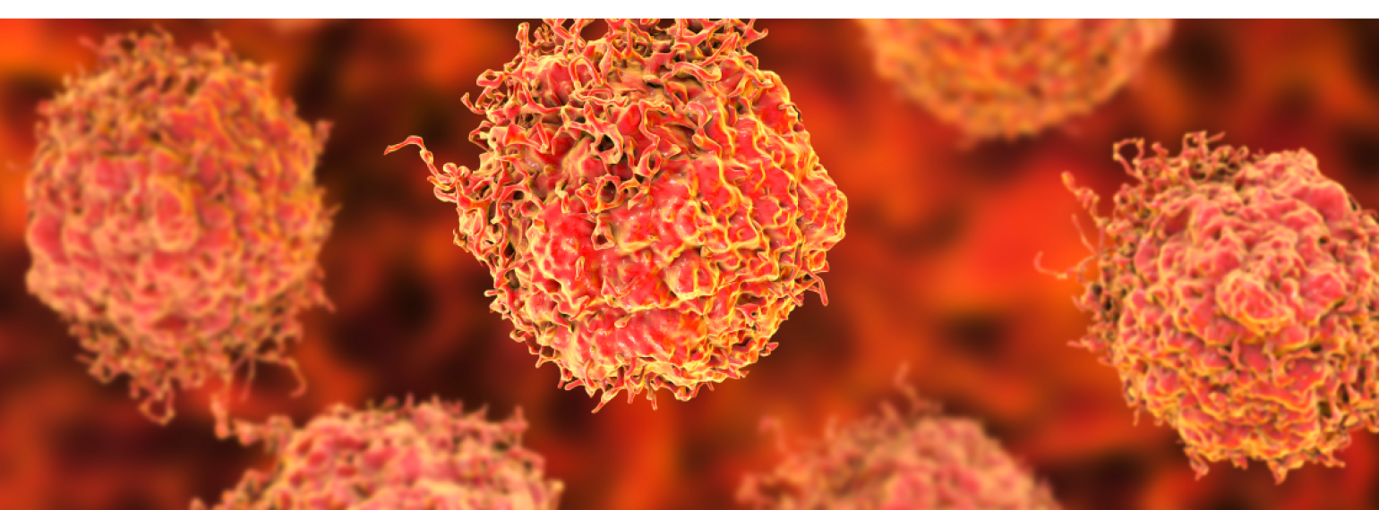 Study Suggests Commonly Used Prostate Cancer Treatment Rewires Engine of Prostate Tumors