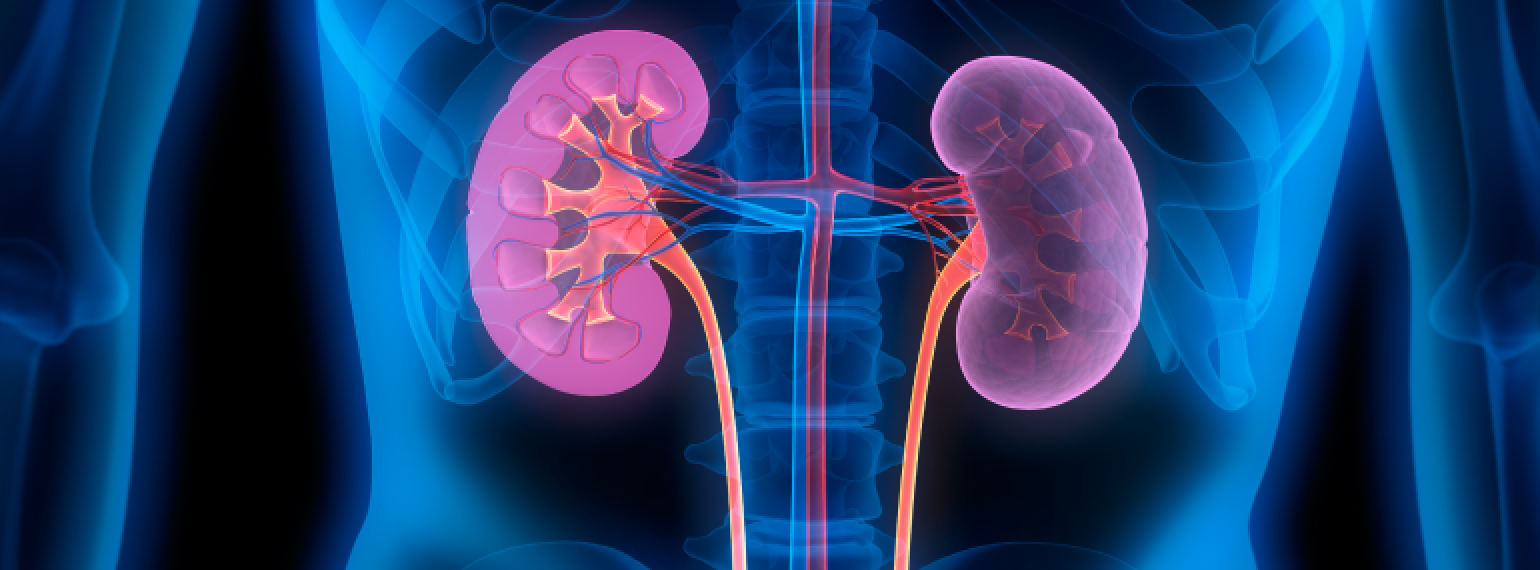 COVID-19 and Dialysis for Acute Kidney Injury
