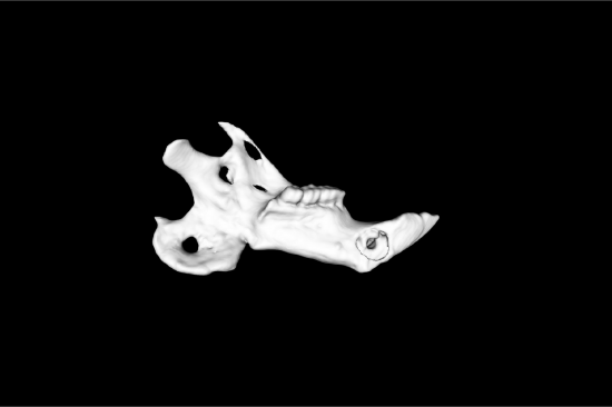 Graphic of bone