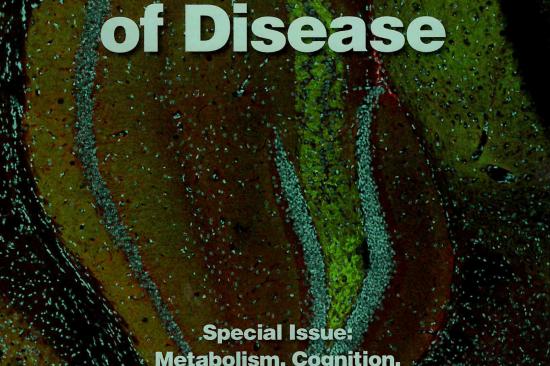 Cover of April Neurobiology of Disease