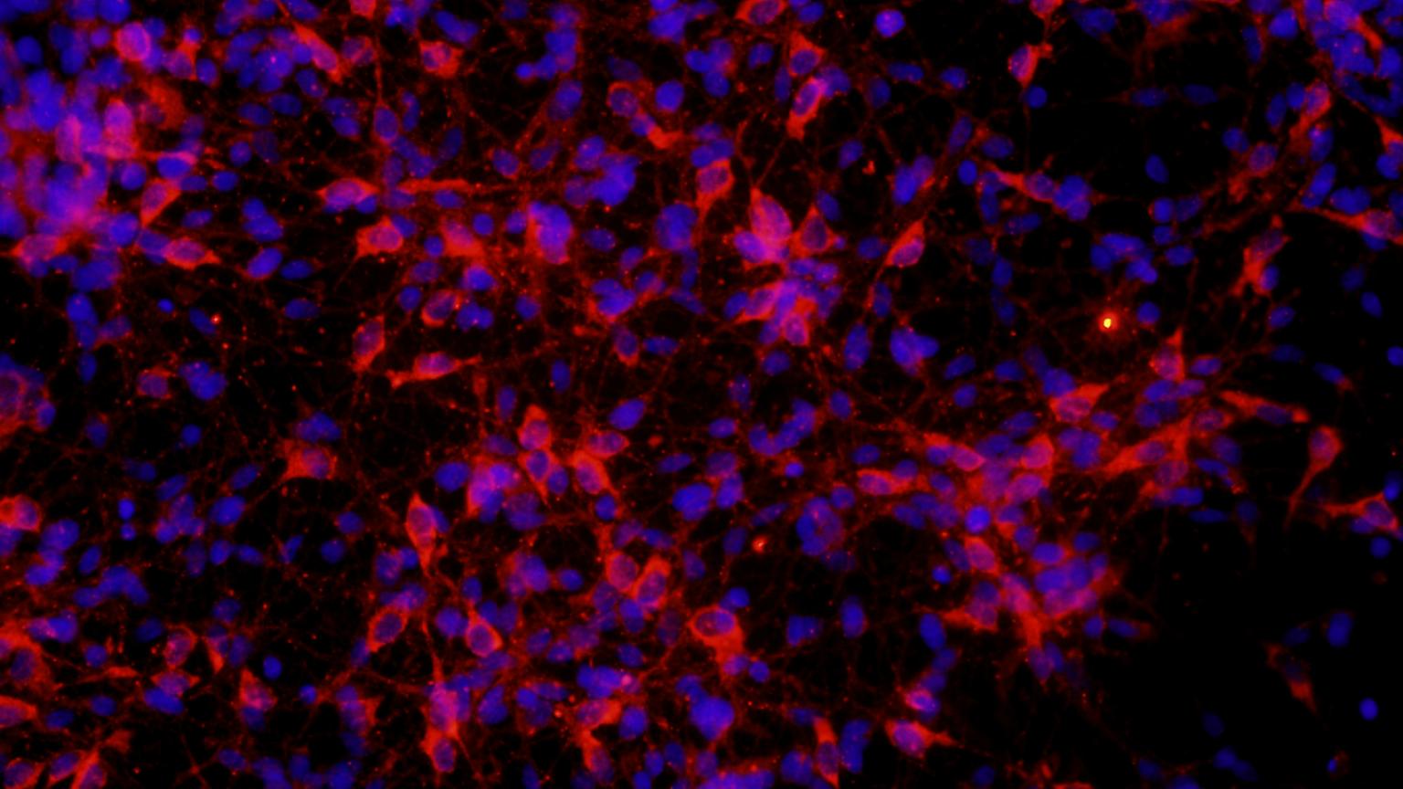 NeuroNetwork for Emerging Therapeis lab photo of brain nerve cells derived from human stem cells