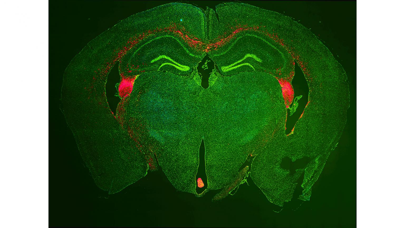 NeuroNetwork for Emerging Therapies lab photo of Mouse brain with transplanted human stem cells (red)