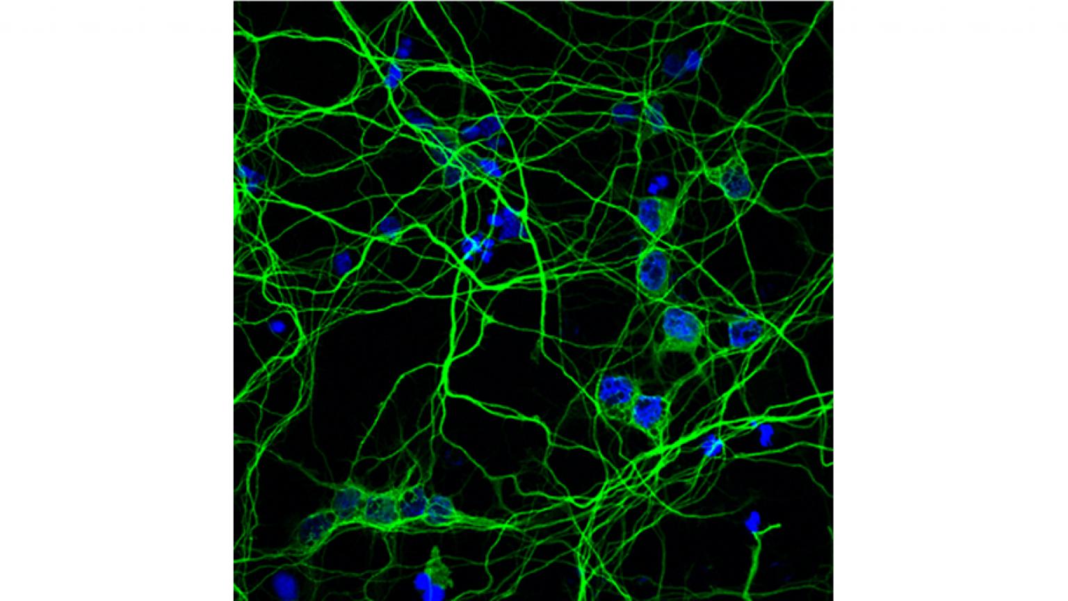 NeuroNetwork for Emerging Therapies photo showing Tau staining in neurites