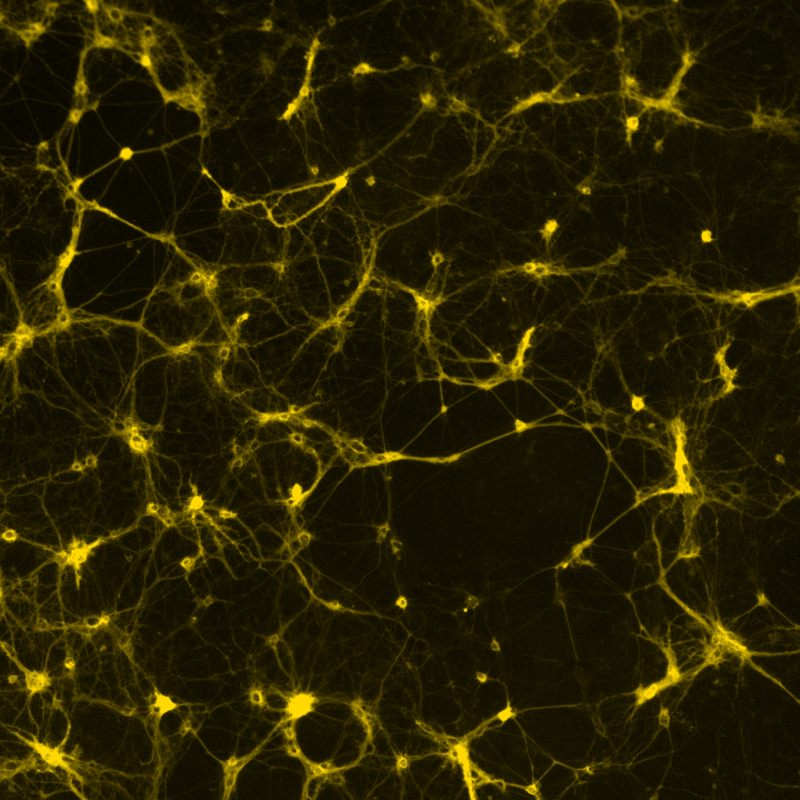 a photo of calcium from motor neuron activation by neurotransmitters taken by the NeuroNetwork for Emerging Therapies, Michigan Medicine