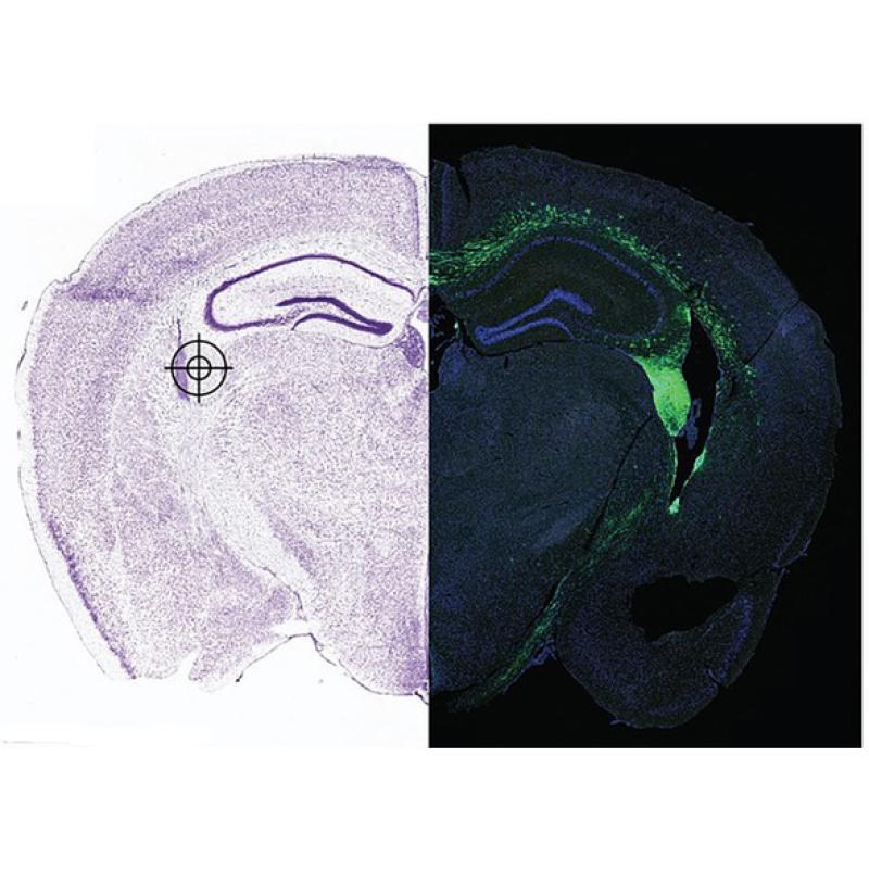 Brain from pre-clinical model with stem cells transplanted into the hippocampus (green on right)