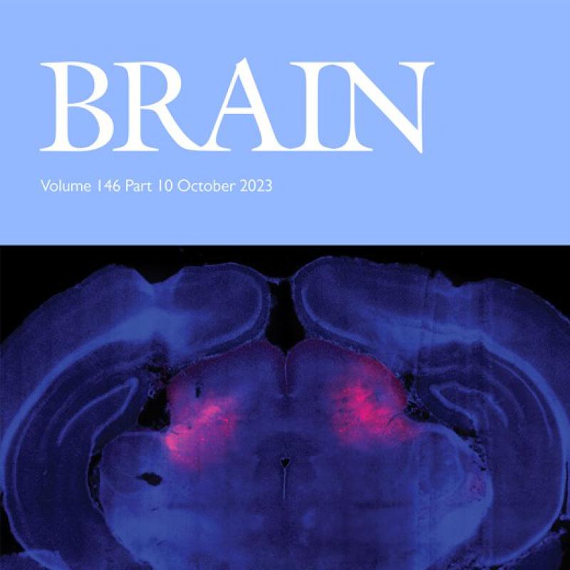 October cover of Brain