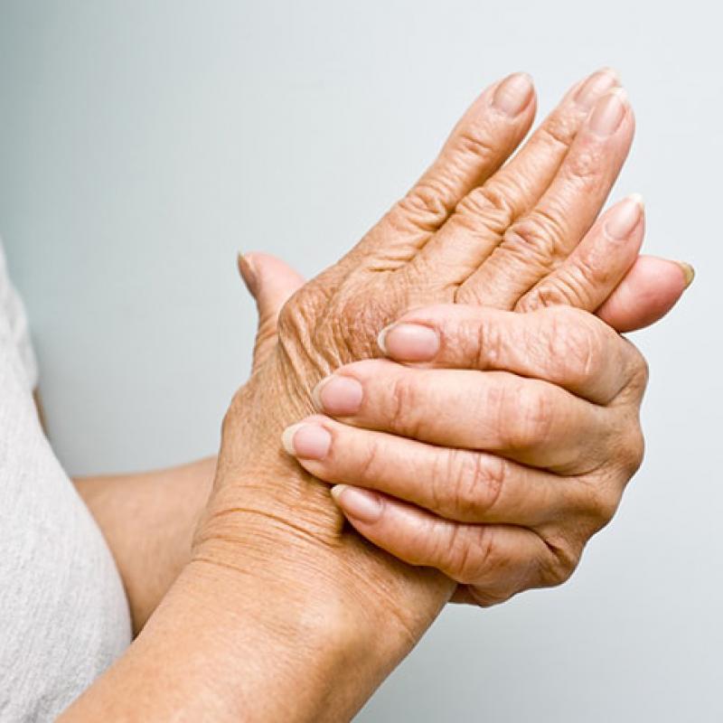 Genetic Prediction Model Helps Identify Arthritis Risk in Psoriasis Patients