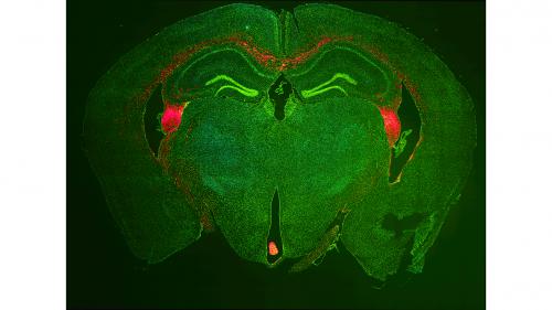 NeuroNetwork for Emerging Therapies lab photo of Mouse brain with transplanted human stem cells (red)