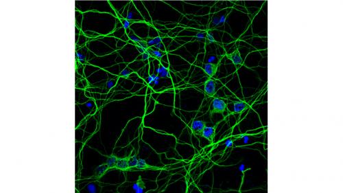 NeuroNetwork for Emerging Therapies photo showing Tau staining in neurites