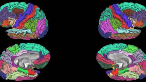 NeuroNetwork for Emerging Therapies Lab photo of MRI dynamic color mapping that qualitates different brain regions